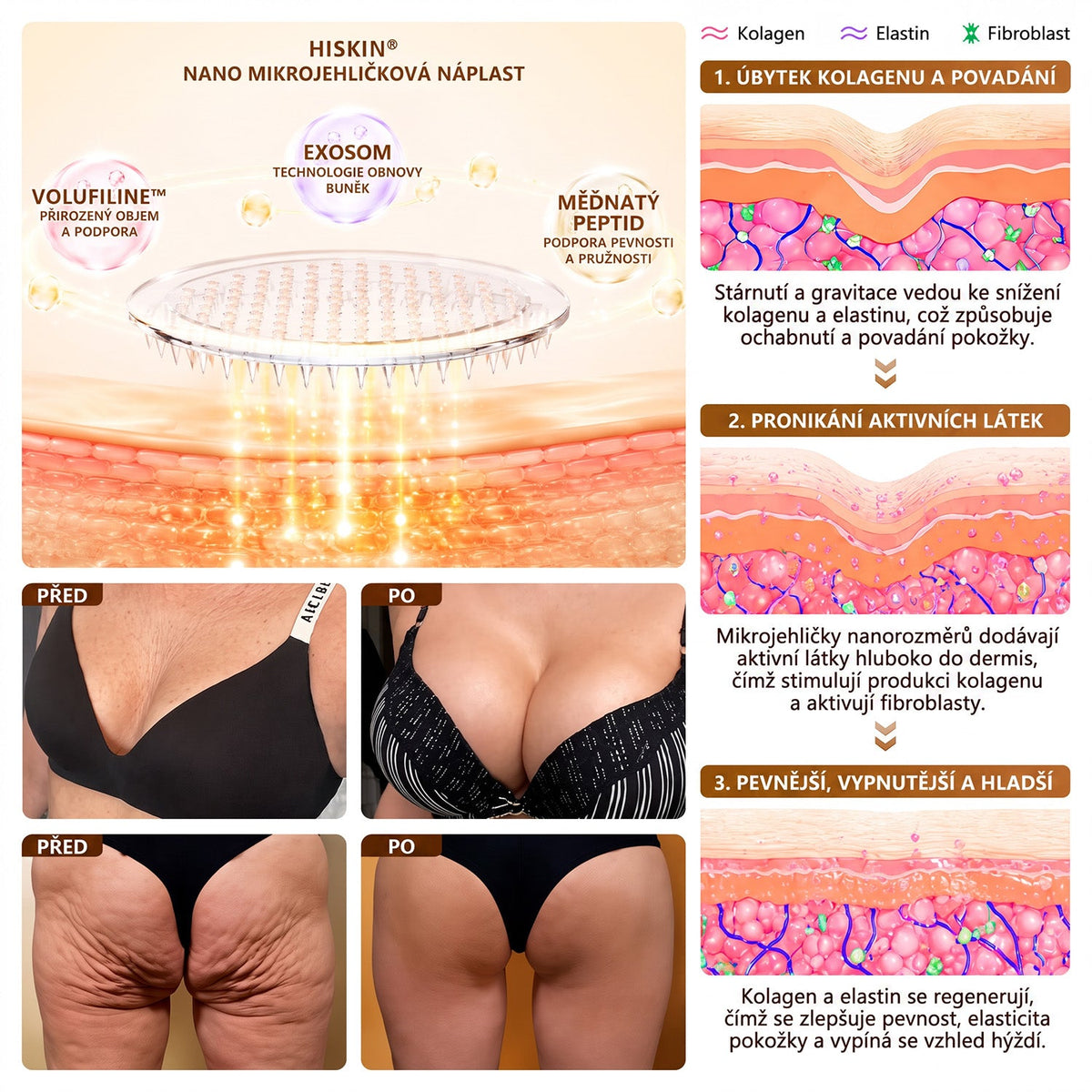 HISKIN®🏆 Náplasť s nano mikroihličkami pre objem, pozdvihnutie a spevnenie poprsia – Volufiline + Exosome + Copper Peptide formula podporená technológiou bunkovej obnovy