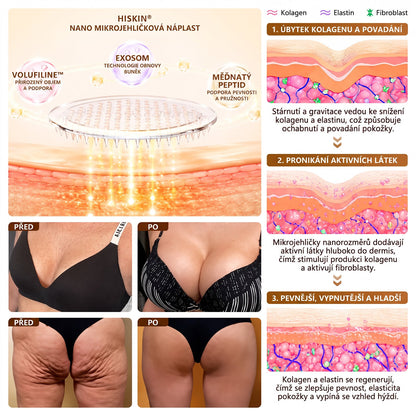 HISKIN®🏆 Náplasť s nano mikroihličkami pre objem, pozdvihnutie a spevnenie poprsia – Volufiline + Exosome + Copper Peptide formula podporená technológiou bunkovej obnovy